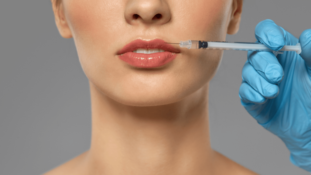 Stages Healing Lip Filler Swelling Timeline – Everything You Need To Know