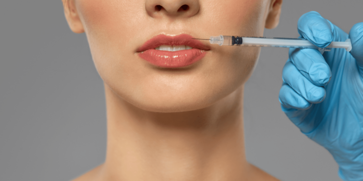 Stages Healing Lip Filler Swelling Timeline – Everything You Need To Know